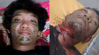 Man Got Throat Slit, Stabbed Multiple Times During Argument In Indonesia