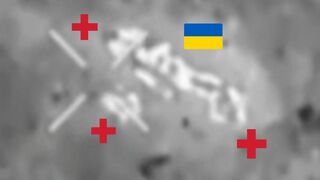 Ukrainian doctors vs. explosive.