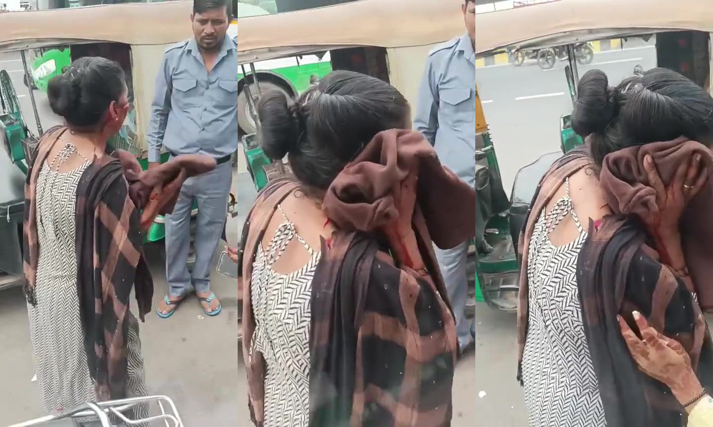 Face slashed by phone thief
