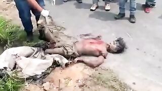 Parts of a dismembered man's body