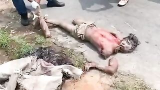 Parts of a dismembered man's body