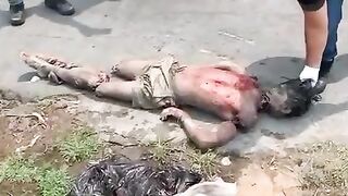 Parts of a dismembered man's body