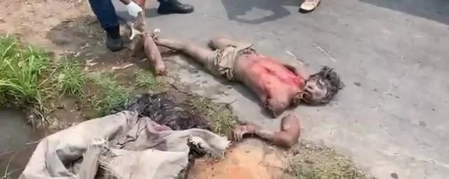 Parts of a dismembered man's body