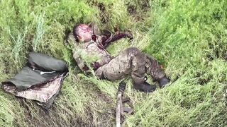 Nasty Russian Gets a Fatal Facelift: Enters Hell in Agony!