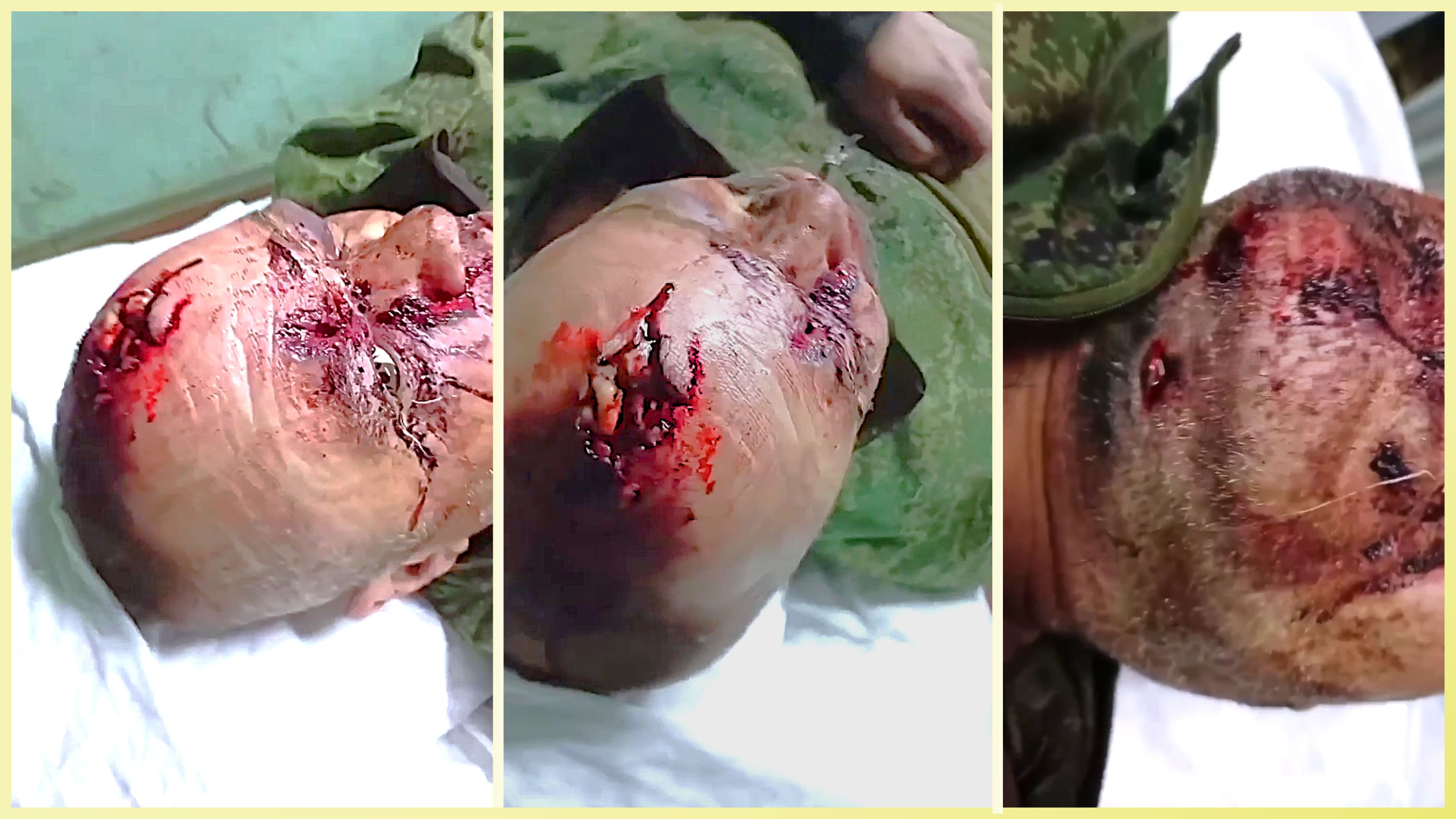 Dismal Russkie Tried Blow His Brains Out—It Failed!