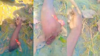 Arm severed