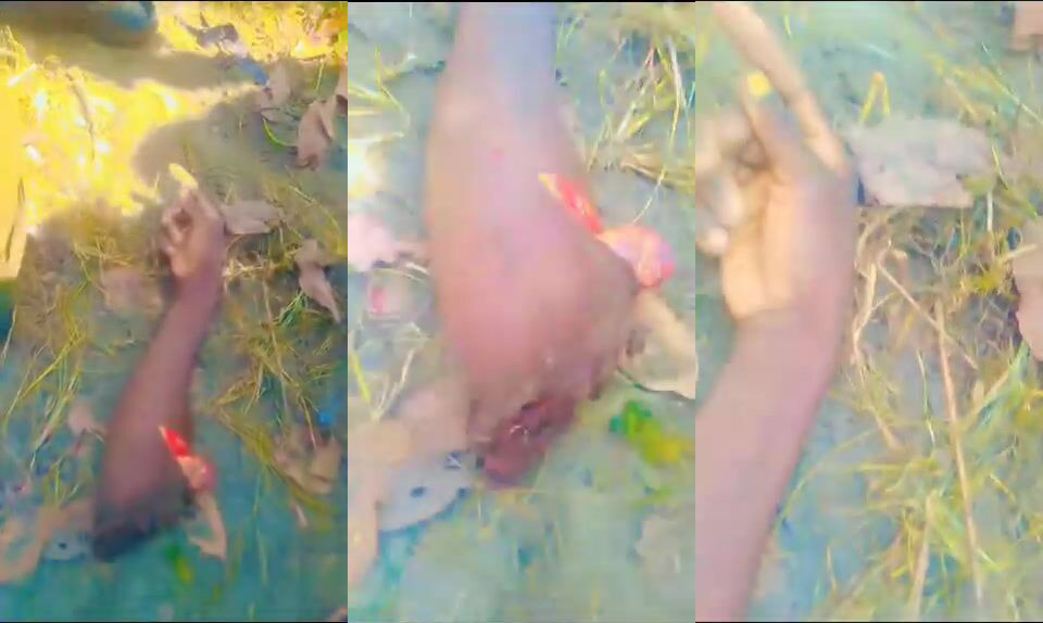 Arm severed