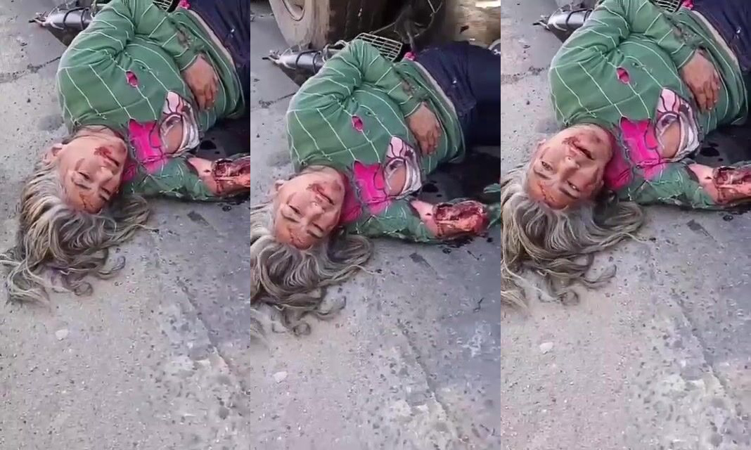 Poor Elderly Woman Seriously Injured In Traffic Accident In Brazil