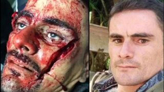 Fatal Machete blow to the face
