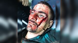 Fatal Machete blow to the face