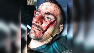 Fatal Machete blow to the face