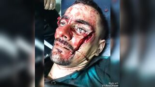 Fatal Machete blow to the face