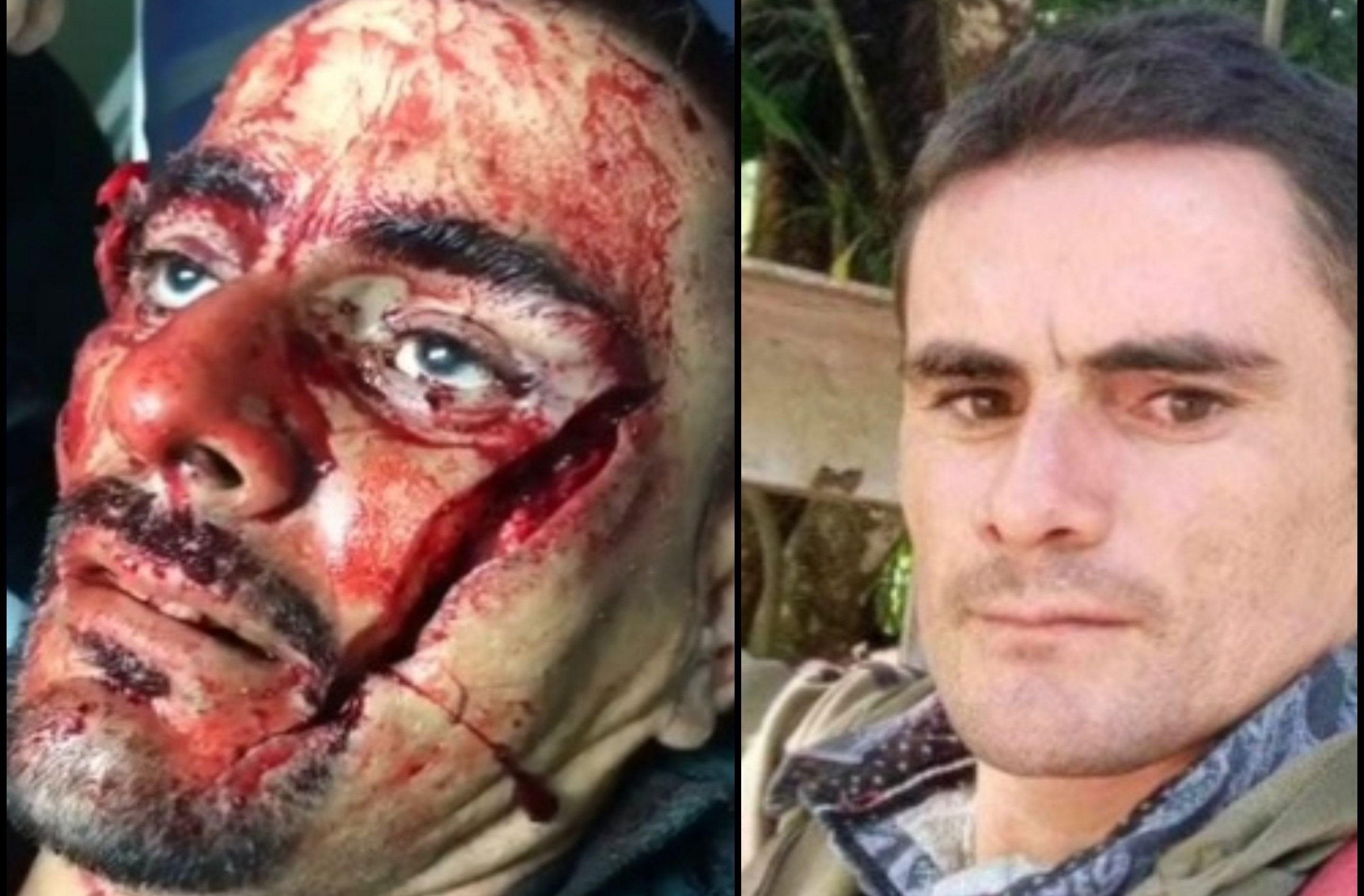 Fatal Machete blow to the face