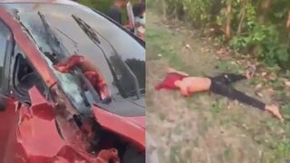 Motorcyclist Left Arm, Life In A Windshield