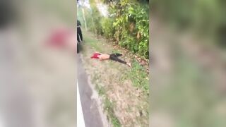 Motorcyclist Left Arm, Life In A Windshield