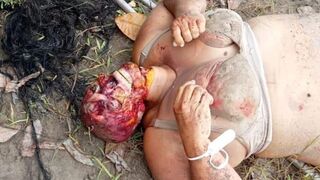 Brutal Murder Mystery: Community Health Agent Found With Skull Crushed