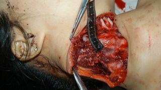 Nasty Machete comp