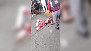 Woman Suffers Terrible Injures Dies Hours Later