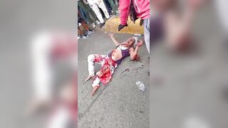 Woman Suffers Terrible Injures Dies Hours Later