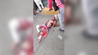 Woman Suffers Terrible Injures Dies Hours Later