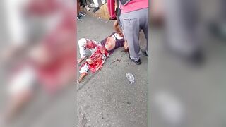 Woman Suffers Terrible Injures Dies Hours Later