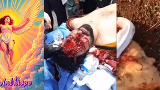 Gore Compilation