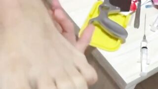 PLAYING WITH AMPUTED FOOT