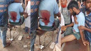 Man impaled with rebar