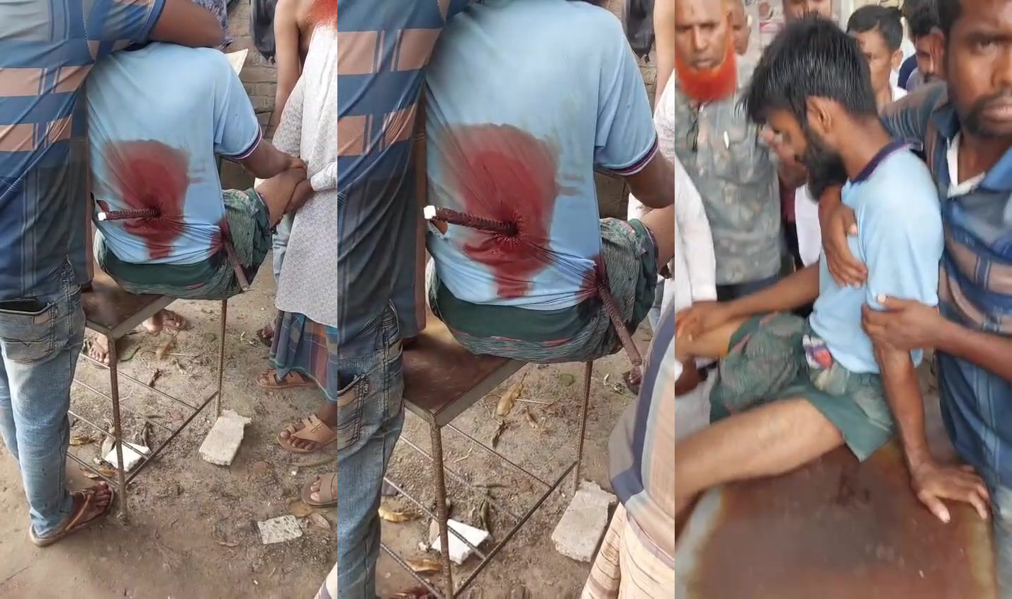 Man impaled with rebar