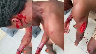 Man attacked with machete