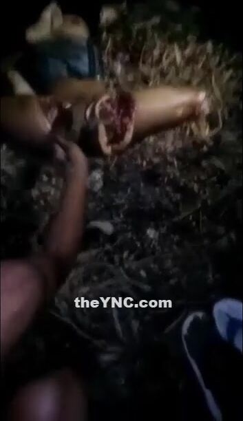 Woman being dismembered