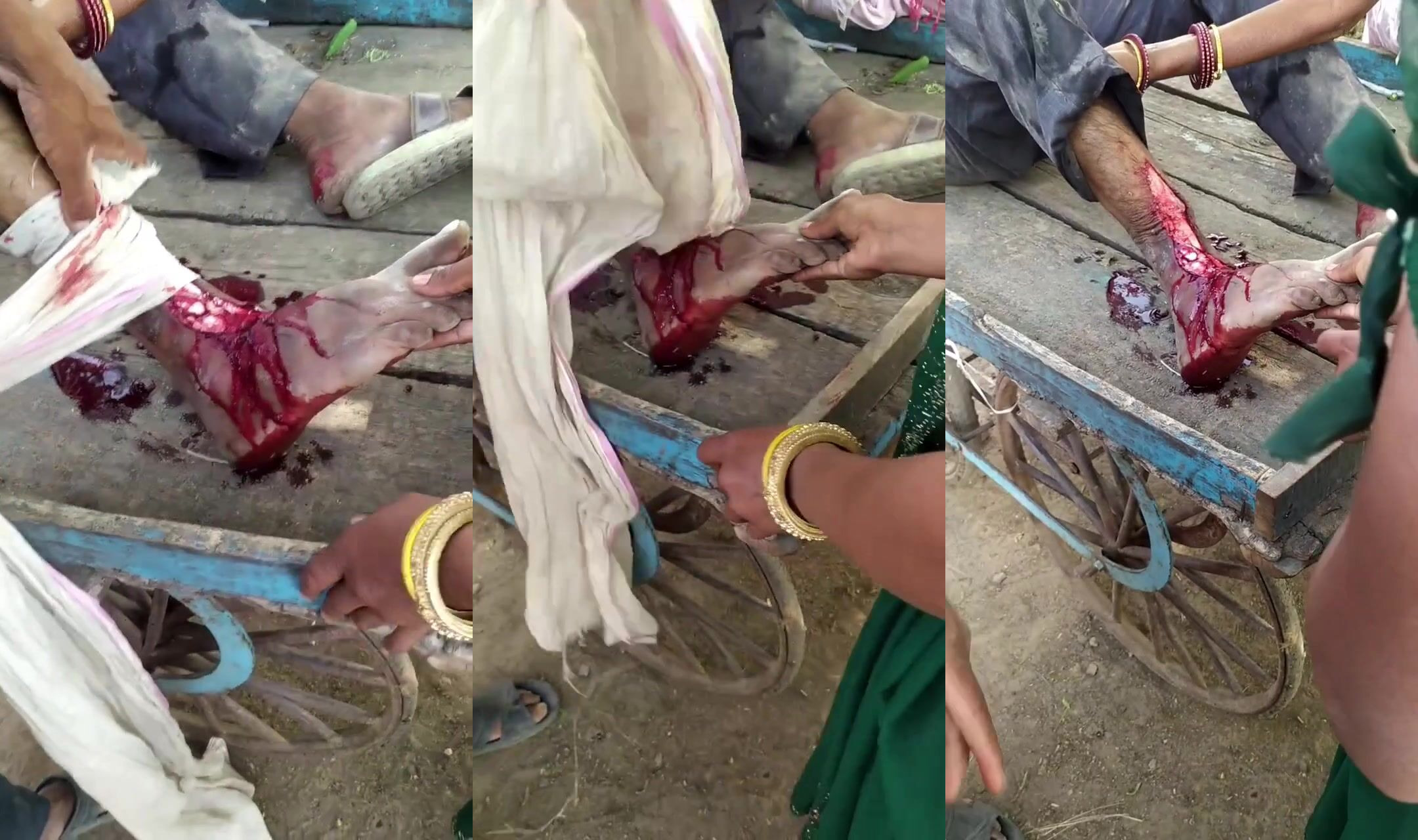Say goodbye to your foot