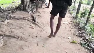 Soldiers leg destroyed Myanmar