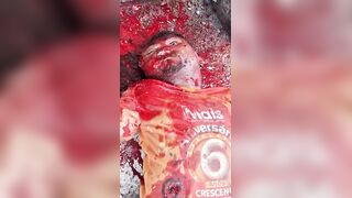 Man Executed By CV Gang Left With Face Disfigured