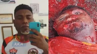 Man Executed By CV Gang Left With Face Disfigured