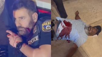 Suspect Who Shot A Philly Cop Took A Bullet In Stomach