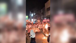 Fire Breather Engulfed in Flames During Stunt, Suffers Burns