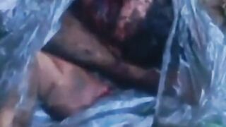 Head, torso, and limbs of a dismembered man