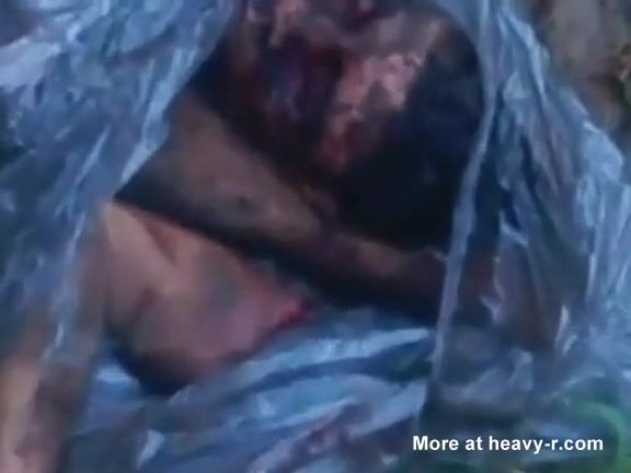 Head, torso, and limbs of a male corpse