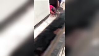 Woman Scalped During Pitbull Attack In Nicaragua