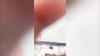 Woman Scalped During Pitbull Attack In Nicaragua