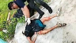 Assembly of a dismembered body