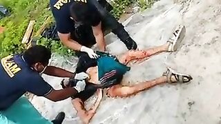 Assembly of a dismembered body