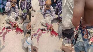 Orange haired man talks calmly on phone after moto accident