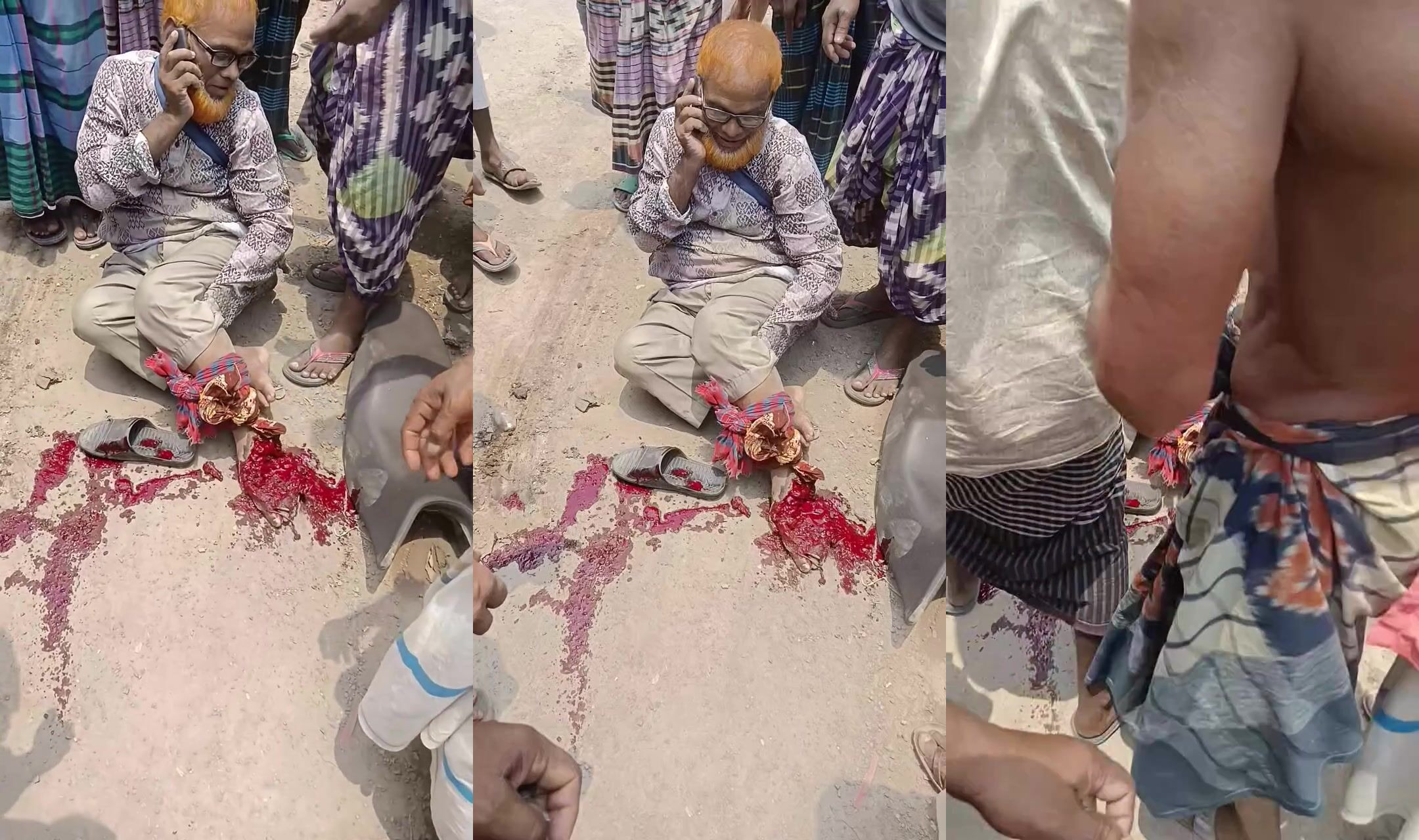 Orange haired man talks calmly on phone after moto accident