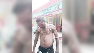 Man Self-Immolates After His Brother Was Arrested