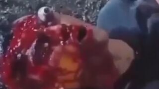 Motorcyclist Lost An Eye During Street Race In Colombia