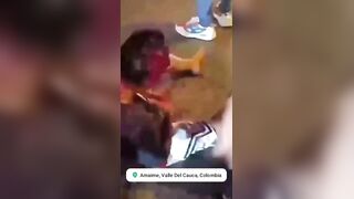 Motorcyclist Lost An Eye During Street Race In Colombia