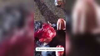 Motorcyclist Lost An Eye During Street Race In Colombia