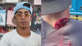 Man Attacked With Machete In Dominican Republic